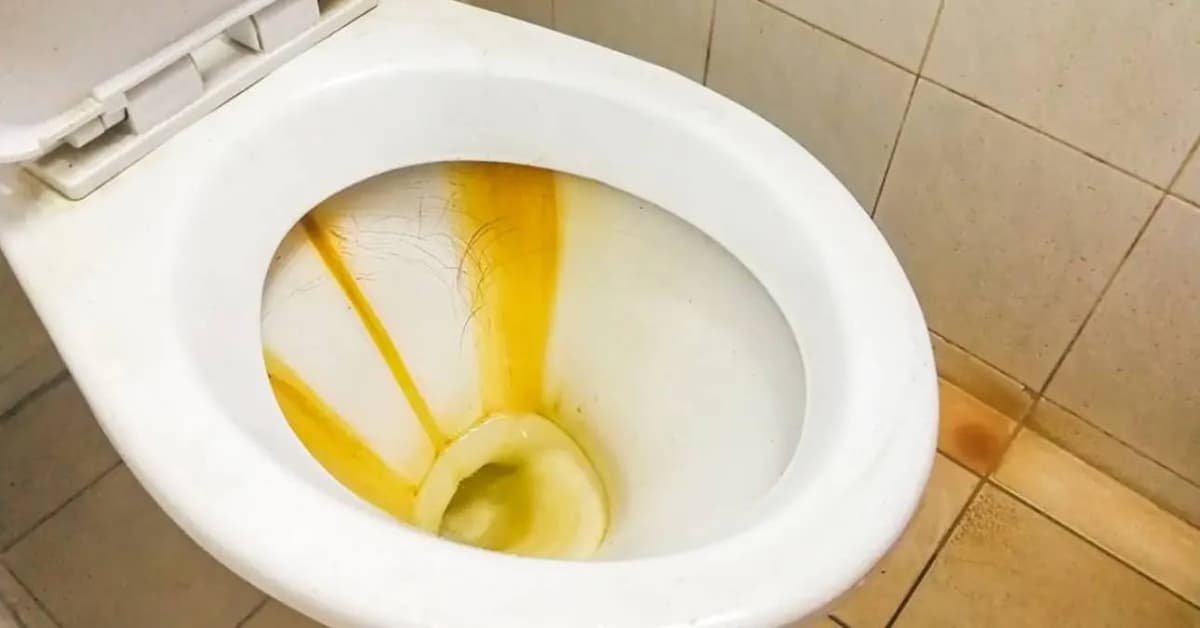 une cuvette de WC remplit de tartre et de calcaire