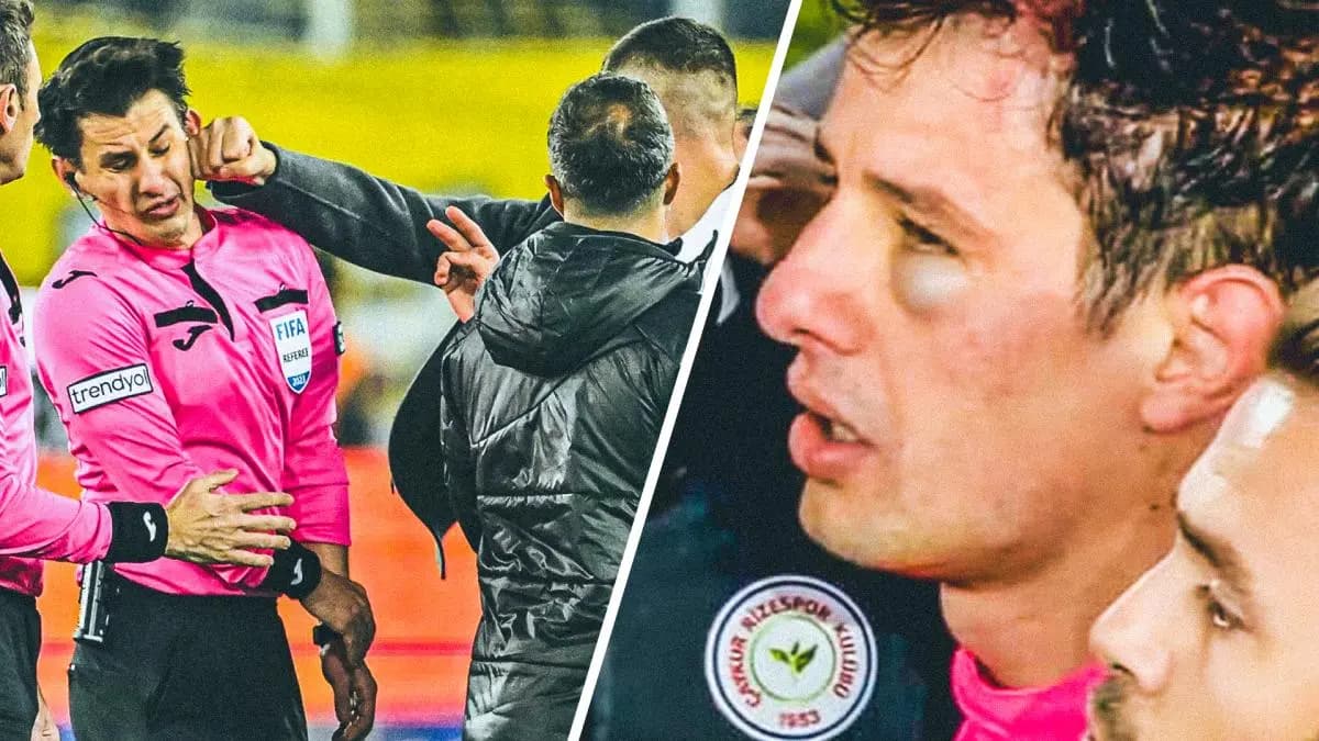 La FIFA condamne l’attaque contre un arbitre turcÂ 