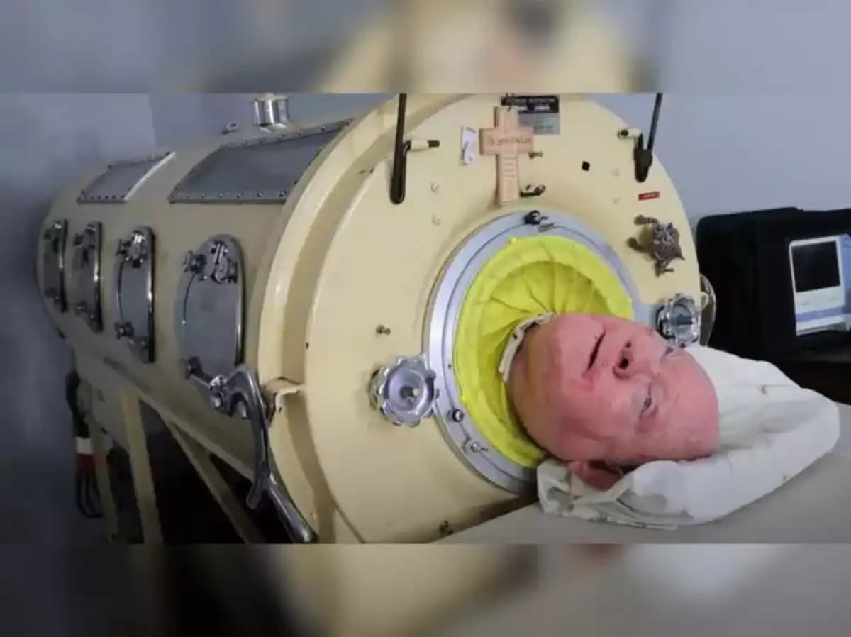 Paul Alexander, homme en poumon de fer, célèbre pour sa longévité et son combat contre la polio.