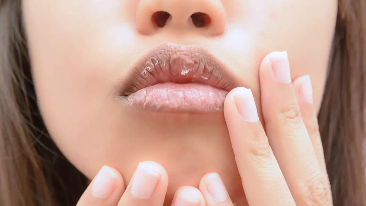 Harmattan: quelques astuces pourÂ éviter d’avoir des lèvresÂ  sèches et gercéesÂ 