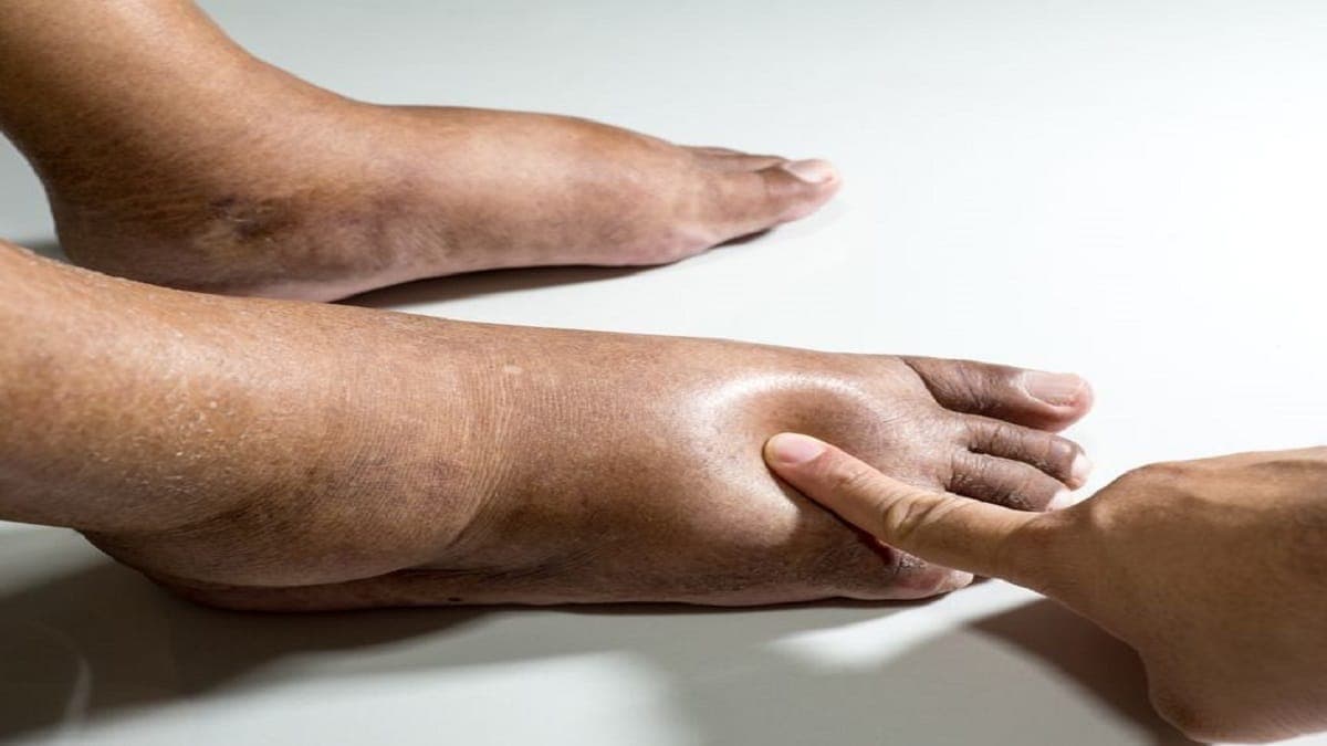 05 astuces naturelles pour soulager les pieds et les chevilles enflés