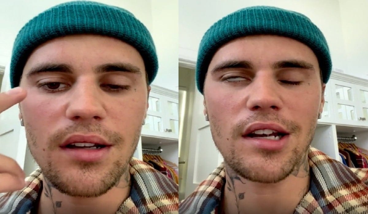 « Je sais que cette tempête passera… »: Justin Bieber évoque sa lutte contre la paralysie faciale