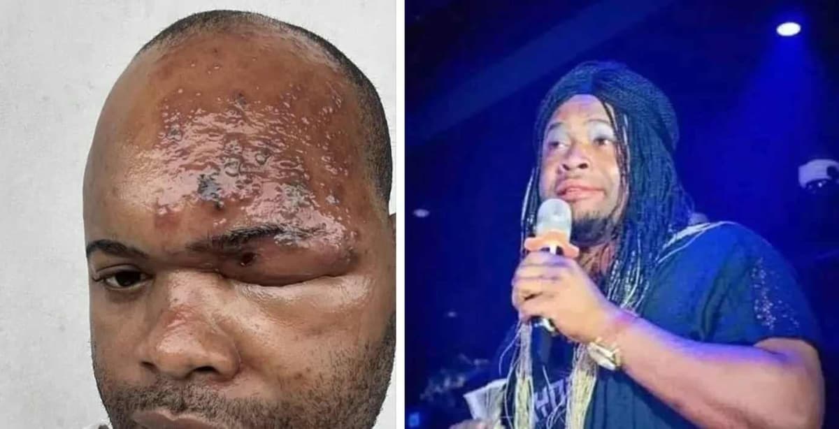 Le comédien Nadamastor gravement malade: ses proches dénoncent un mauvais sort