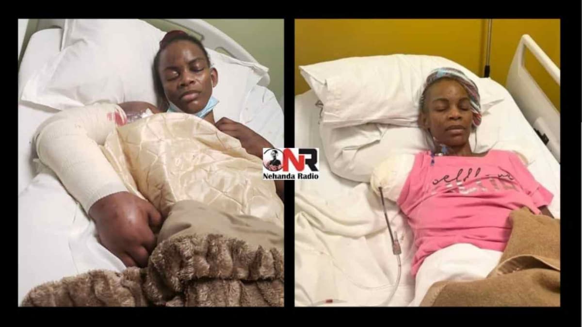 Marry Mubaiwa: amputée d’un bras, la Miss et ex-épouse du VP Zimbabwéen menace de se suicider