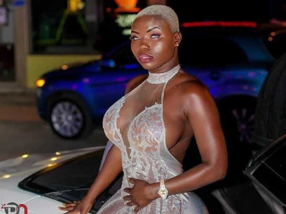 « Mon corps a rejeté la graisse… » Maria Mobil se confie sur son calvaire après avoir refait ses fesses