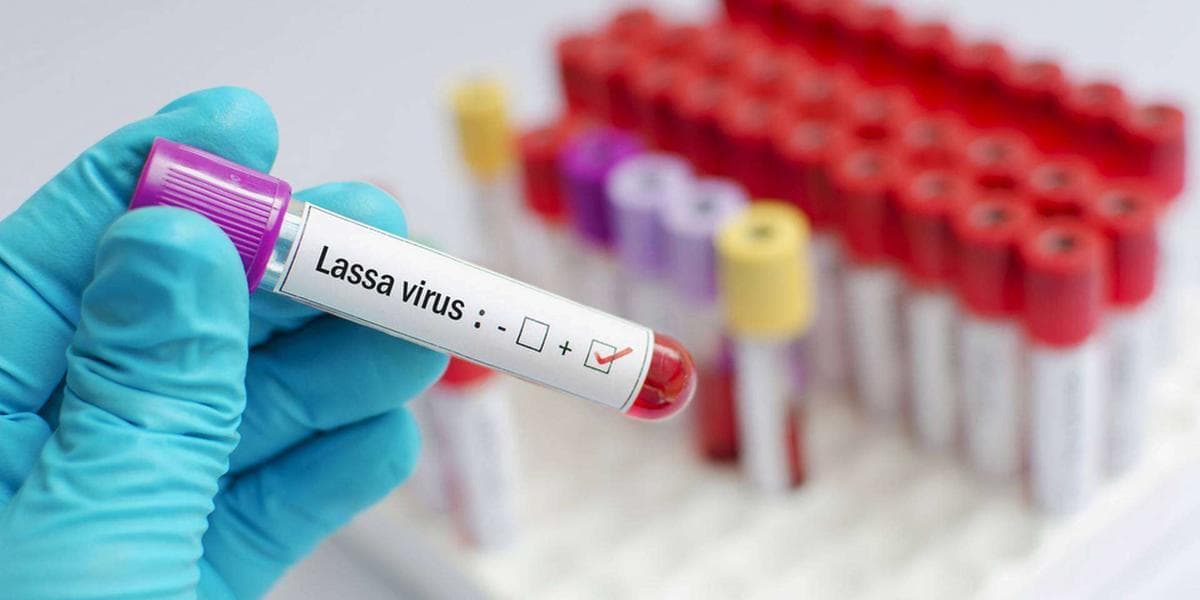 Nigeria: 127 décès et une propagation inquiétante de la fièvre de Lassa