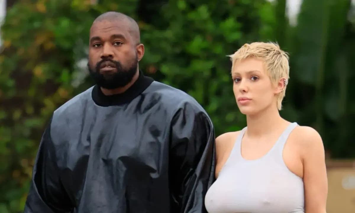 Kanye West au visage bouffi : inquiétudes pour sa santé