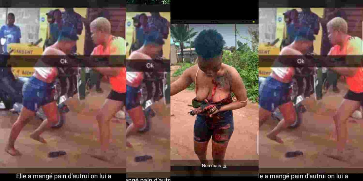 Bénin : deux tiktokeuses gravement blessées dans une bagarre pour un homme