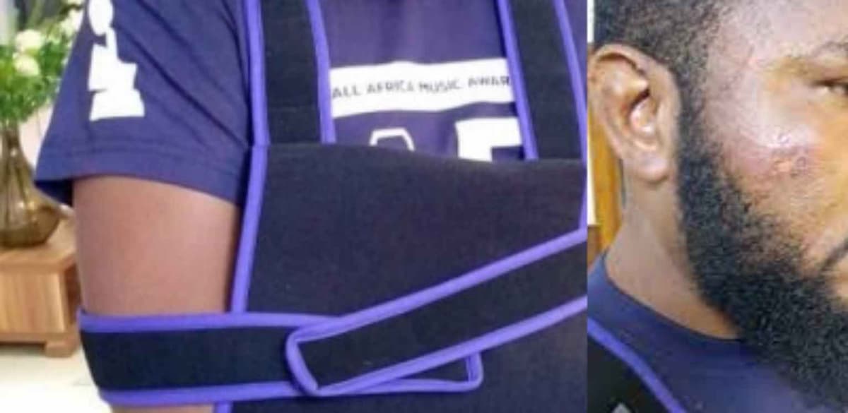 AFRIMA 2023: un responsable agressé par des gendarmes à Dakar, son bras fracturé