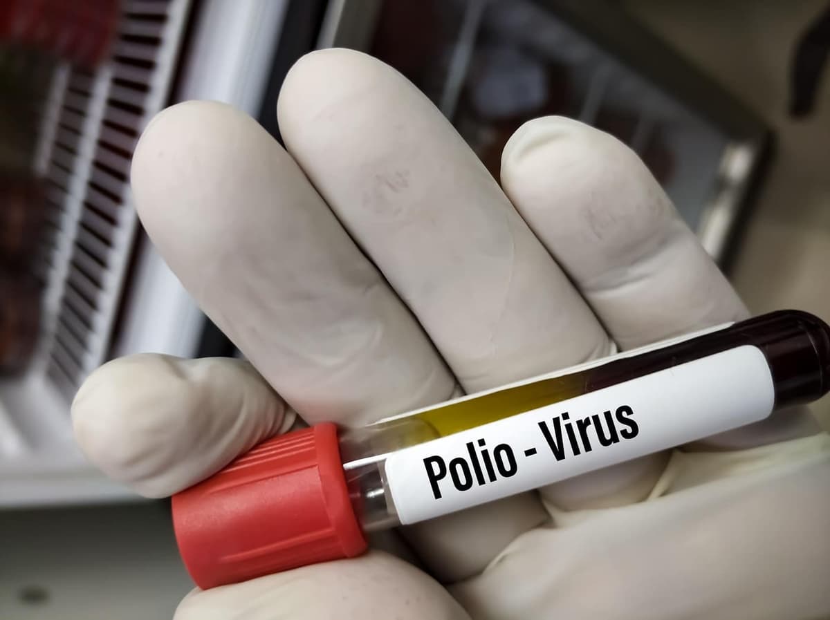 Le Zimbabwe lance une campagne de vaccination d’urgence contre la polio