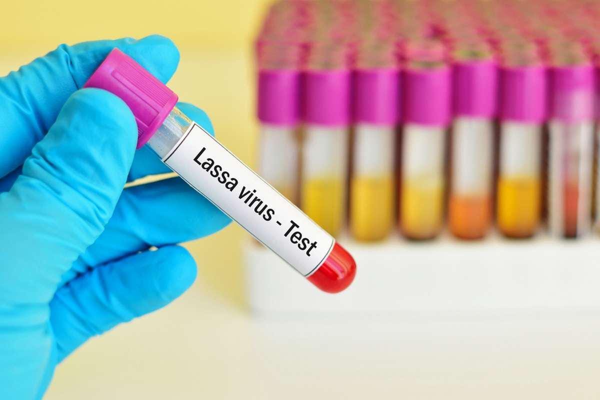 Le Ghana confirme deux cas de fièvre de Lassa