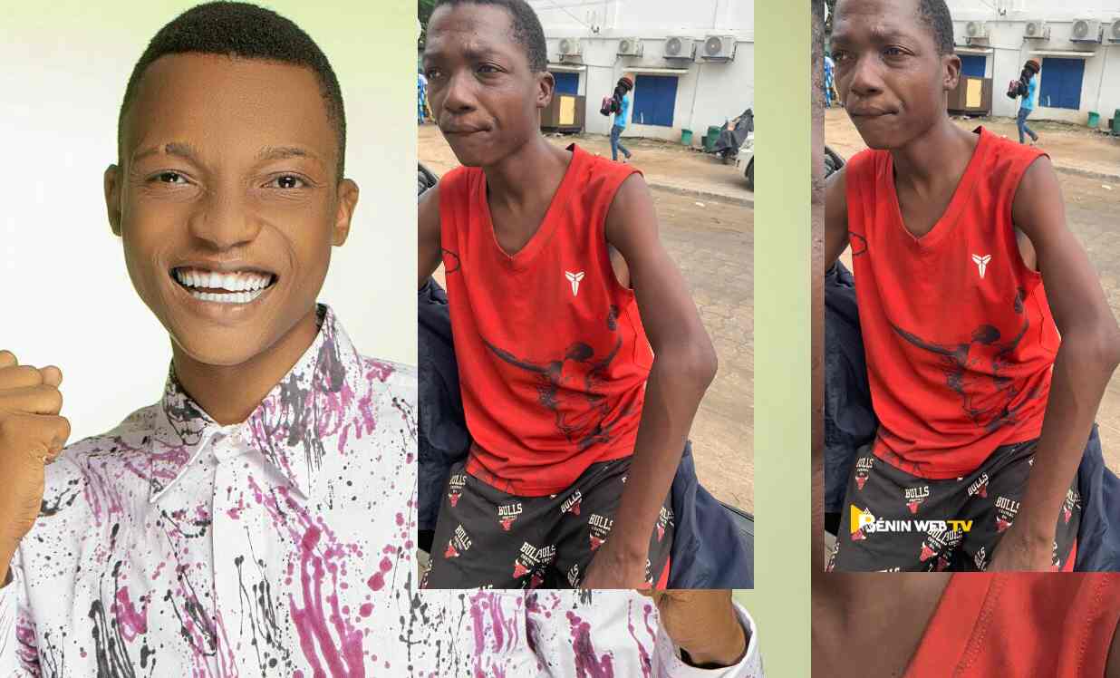 Bénin: malade et très amaigri, le slameur Tchègoun dans un état critique
