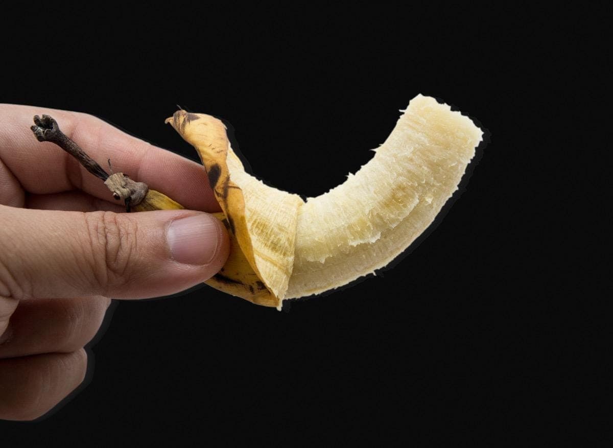 France : un homme, amputé du pénis suite à une erreur médicale, réclame réparation