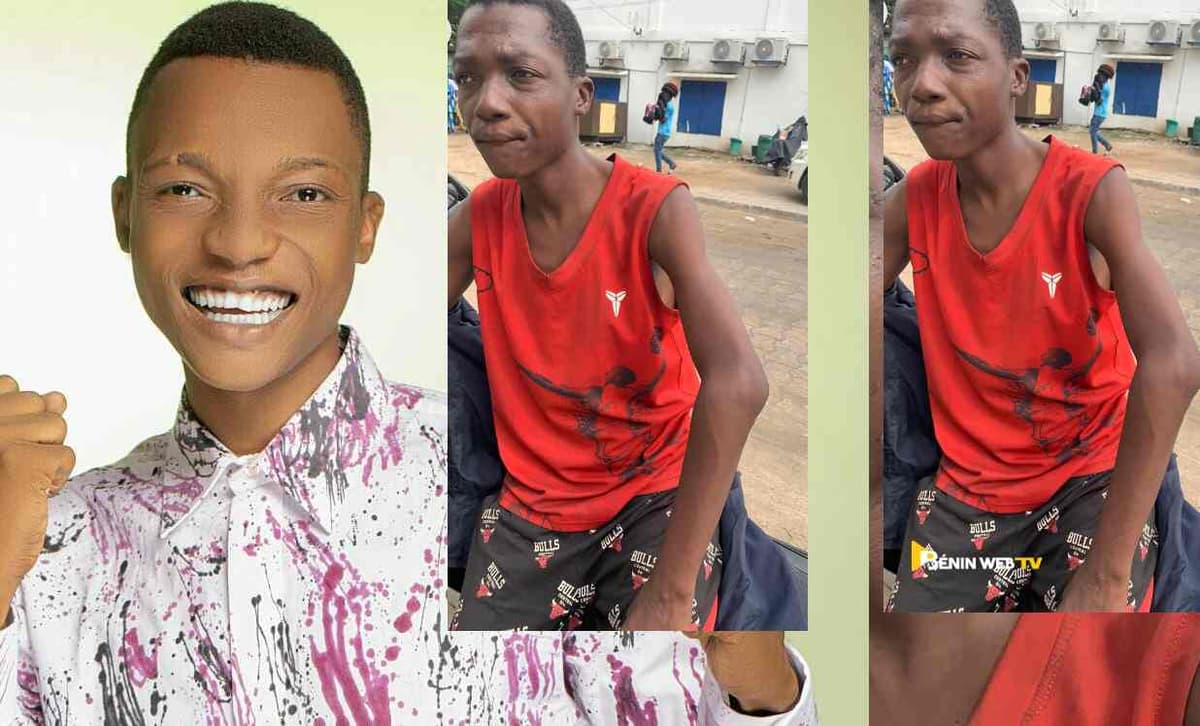 Bénin: malade et très amaigri, le slameur Tchègoun dans un état critique