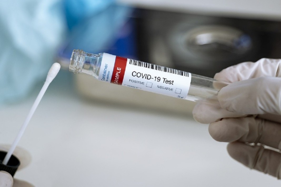 Les tests de dépistage PCR désormais intégrés au paquet d'activités des formations sanitaires au Bénin