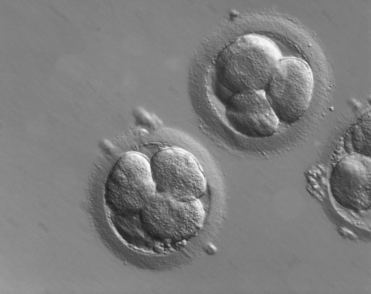 Embryons humains observés lors d’une fécondation in vitro